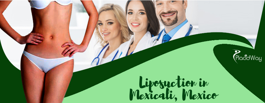 Liposuction in Mexicali, Mexico